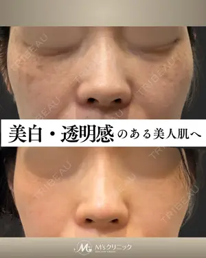 null days after image