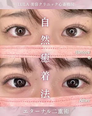 null days after image