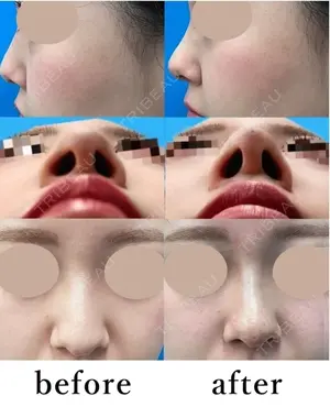 null days after image