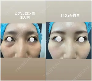 null days after image