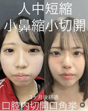 null days after image