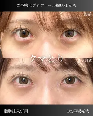 null days after image