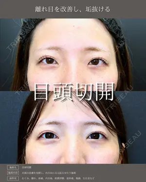 null days after image