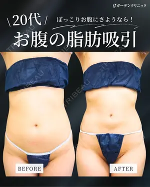 null days after image