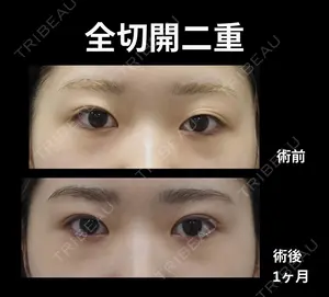 before image