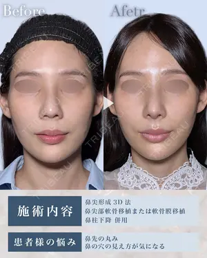 null days after image