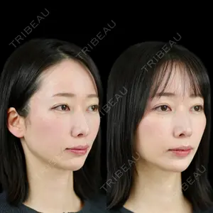 null days after image