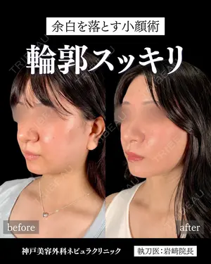 null days after image