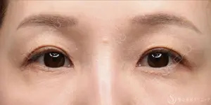 1825 days after image