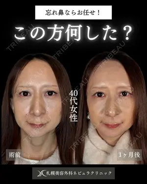 null days after image