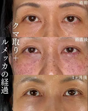 null days after image