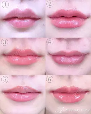 null days after image