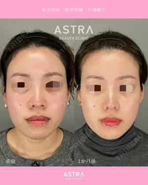 null days after image