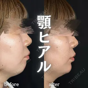 null days after image