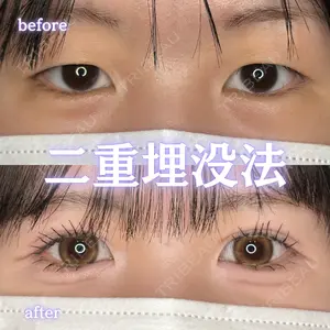 null days after image