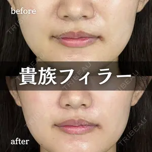 null days after image