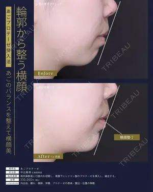 30 days after image