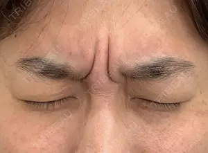 before image