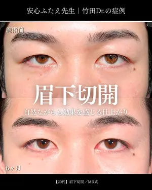 180 days after image