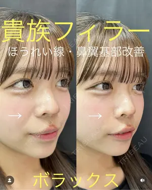 null days after image