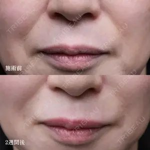 null days after image