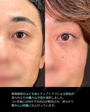 30 days after image