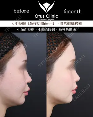 180 days after image