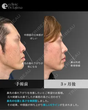 90 days after image