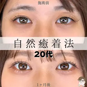 null days after image