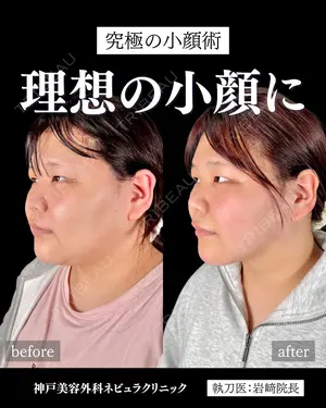 null days after image