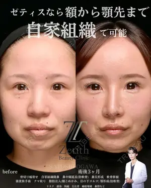 180 days after image