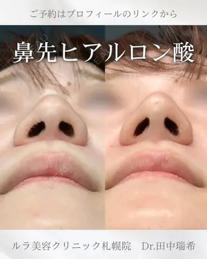 null days after image