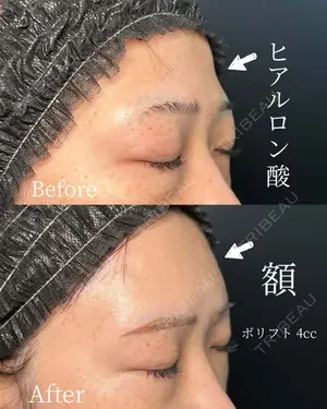 null days after image