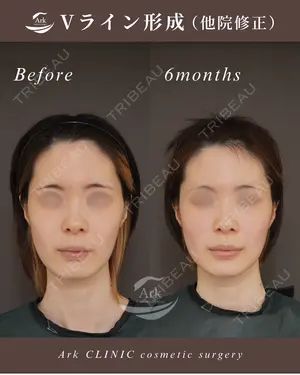 null days after image