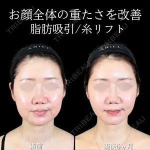 180 days after image