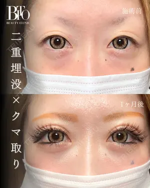 null days after image