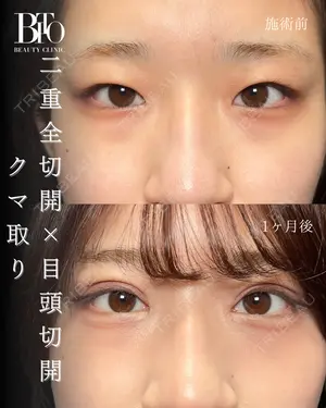 null days after image