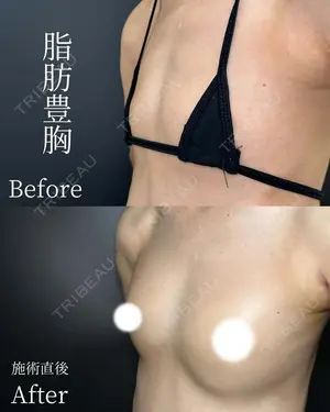 null days after image