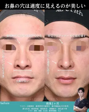 null days after image