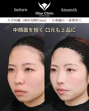 180 days after image