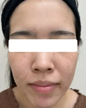 before image