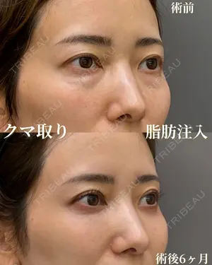 180 days after image