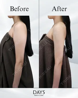 null days after image