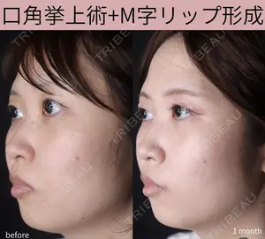 null days after image