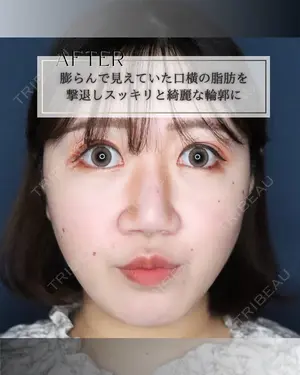 null days after image