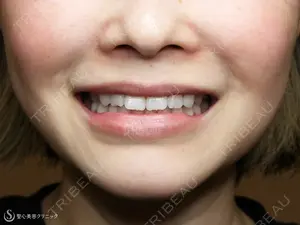 1350 days after image