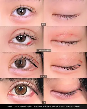 365 days after image