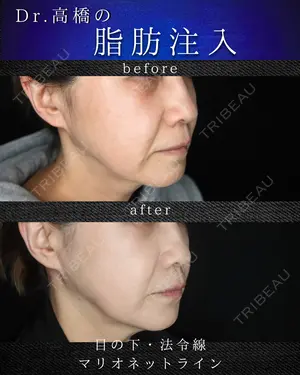 null days after image