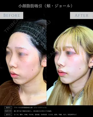 null days after image