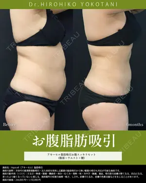 181 days after image